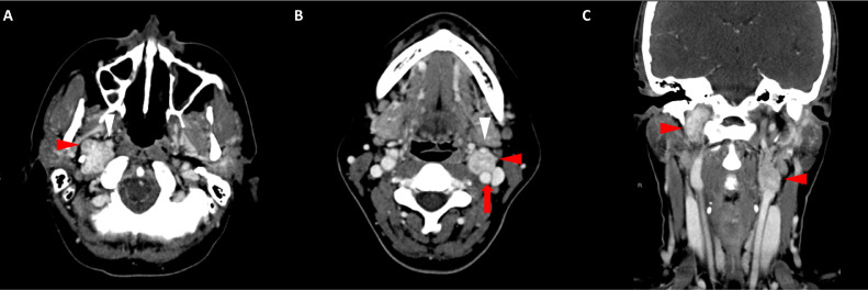 Fig. 1  