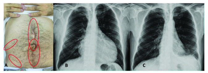 包含图片、插图等的外部文件。对象名称为 turkjmedsci-50-1591-fig001.jpg