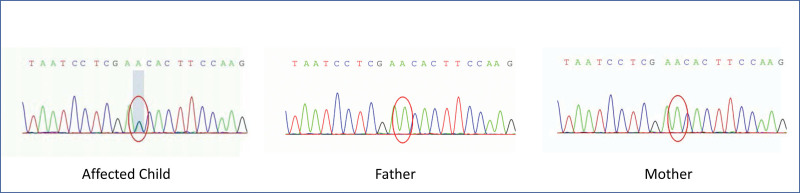 An external file that holds a picture, illustration, etc.
Object name is medi-102-e33587-g001.jpg