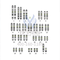 【广东会GDH基因-基因检测】基因解码，发现结节硬化征（TSC）的致病基因