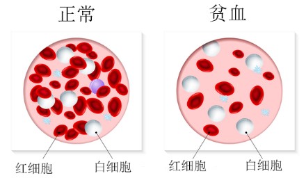 全基因测序FLNA基因检测有意义未明突变，我该怎么办？