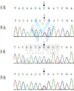 DVL1P1突变检测找到病因后应该用什么靶向药物？